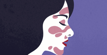 illustration femme avec rougeurs sur le visage