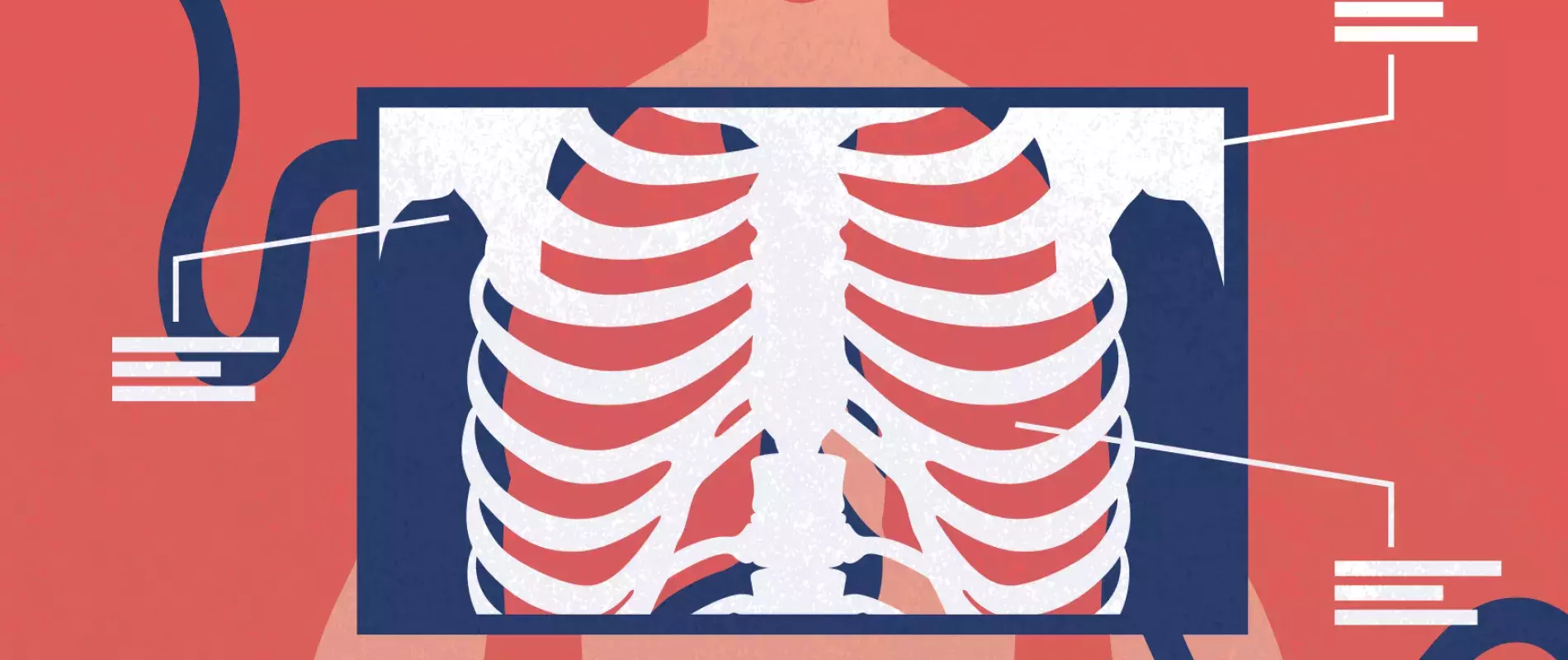 imagerie médicale poumons