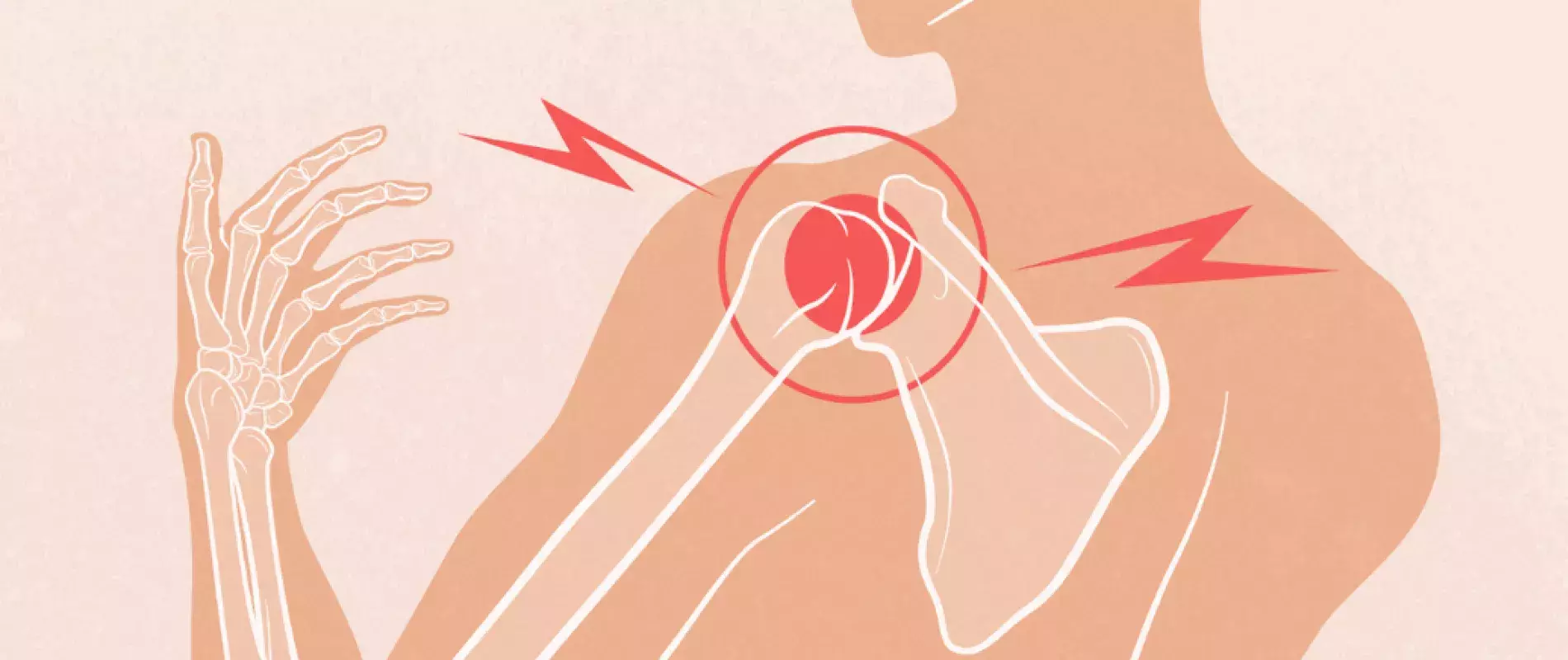 illustration d'un point rouge sur l'articulation de l'épaule