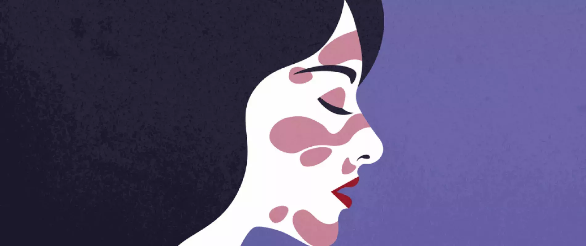 illustration femme avec rougeurs sur le visage