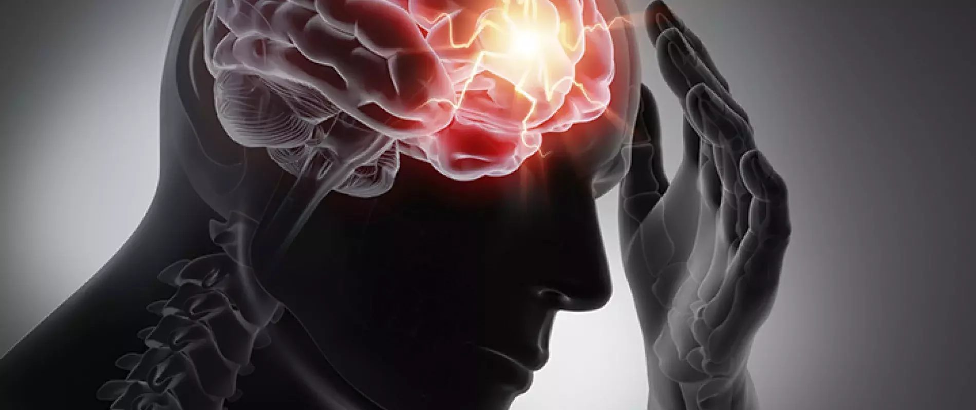 9 faits sur l'épilepsie, une maladie toujours mal connue | MMJ